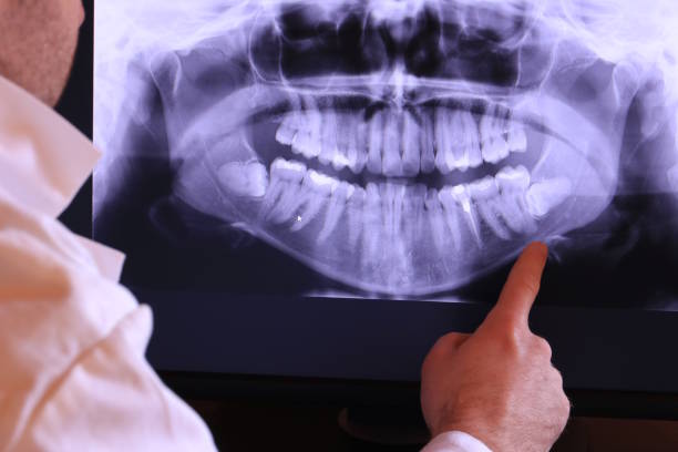 Best Emergency Treatment for Dental Infections or Abscesses in Central Square, NY